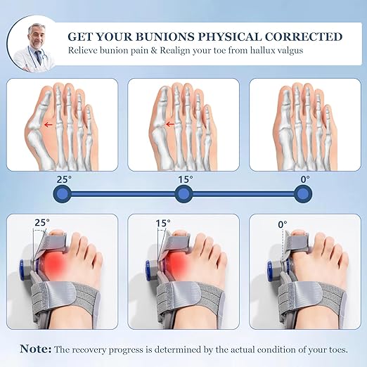 FeetFix Bunion Corrector