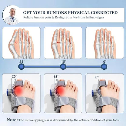 FeetFix Bunion Corrector